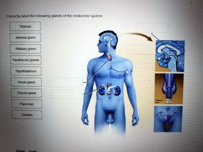 Correctly label the following glands of the endocrine system